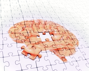A jigsaw puzzle with an image of a human brain, mostly completed except for one missing piece in the center—symbolizing memory loss after a car accident—which is placed nearby. A jigsaw puzzle with an image of a human brain, mostly completed except for one missing piece in the center—symbolizing memory loss after a car accident—which is placed nearby.