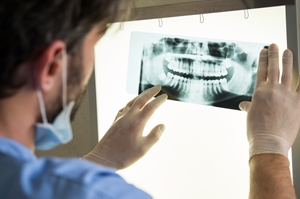 A person wearing gloves and a mask examines a dental X-ray image on a lightbox, carefully checking for signs that could indicate dental malpractice in the clear view of teeth and jaw. A person wearing gloves and a mask examines a dental X-ray image on a lightbox, carefully checking for signs that could indicate dental malpractice in the clear view of teeth and jaw.